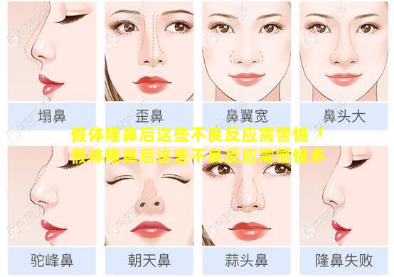 假体隆鼻后这些不良反应需警惕「假体隆鼻后这些不良反应需警惕多 🐳 久」